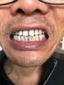 HIEUAILR牙垢牙結(jié)石專用去黃去牙漬去煙漬牙齒清潔器去除器搭牙膏去口臭 曬單實(shí)拍圖
