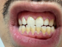 高露潔（Colgate）【孫穎莎同款】速感白美白牙膏亮白去黃去煙漬85g 新老包裝隨機 曬單實拍圖