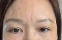秋雅奈緒川字紋貼去除神器男女士去抬頭紋法令紋懸紋睡覺(jué)填充除皺紋專用 買(mǎi)2送1【99%顧客選擇】一抹消紋 曬單實(shí)拍圖
