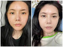 OHBT黃芪面膜10片抗皺緊致抗衰老補(bǔ)水熬夜美白淡斑女男士金榜第1名 曬單實(shí)拍圖