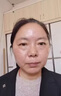 碧素堂祛斑霜美白淡化老年黃褐雀斑去斑去黑色素男士老年斑臉部手背祛斑 強(qiáng)效特效霜:一盒裝【醫(yī)用正品】 專用霜去老人斑淡化淡斑醫(yī)用正品 曬單實(shí)拍圖