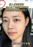 焦博士日本熊果苷乳膏煙酰胺凝膠377美白祛斑霜祛斑美白淡化黑色素面霜 曬單實(shí)拍圖