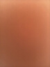 dyey醫(yī)研痘痘貼消炎吸膿隱形遮瑕抗痘祛痘可化妝水膠體貼圓形透明72貼 曬單實(shí)拍圖