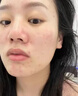 去痘痘和痘印祛痘消炎痤瘡專用粉刺青春痘祛痘專用效藥中藥反長痘膿瘡粉刺痤瘡酒糟鼻 北京同仁堂當(dāng)歸苦參丸 2盒【祛痘藥口服 上火清熱解毒長痘】 曬單實拍圖