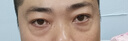 霧嶼森林des眼膜蝦青素眼膜oxy眼膜淡黑眼圈ast眼膜緊致sea眼膜細(xì)紋保濕 2盒 曬單實(shí)拍圖