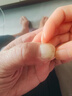 LOSMVFCEE德國(guó)灰指甲特效專用的藥指甲重度殺真菌感染脫甲壞甲100%京自東營(yíng) 三盒裝【空甲壞甲、增厚、發(fā)黑】 曬單實(shí)拍圖