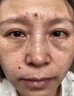 焦博士日本377祛斑霜美白淡化老年黃褐雀斑黑色素熊果苷乳膏去曬男女士 曬單實(shí)拍圖