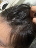 Losoki瑞士進口毛囊炎洗發(fā)水男士去屑止癢控油蓬松除螨洗發(fā)露金榜第1 曬單實拍圖