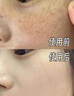 Losoki瑞士進(jìn)口377面膜美白補水淡斑提亮膚色女男士抗皺緊致抗衰老熬夜 曬單實(shí)拍圖