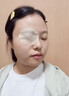京珠堂茶樹(shù)精油眼部除螨眼貼醫用眼睛干澀模糊疲勞有異物螨蟲(chóng)濕巾眼部貼 單盒裝 曬單實(shí)拍圖
