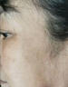 巖井昃弘祛斑霜白美淡化老年人黃褐曬雀斑去斑去黑色素男女士專(zhuān)用點(diǎn)斑藥水 1盒日本進(jìn)口特效純中藥?kù)畎咚?臉部手背效果最好的產(chǎn)品醫(yī)用正品 曬單實(shí)拍圖