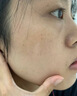 南京同仁堂祛斑霜美白淡化黑色素老年黃褐雀曬斑煙酰胺去黃提亮膚色男女面霜 1瓶【美白淡化】 曬單實(shí)拍圖
