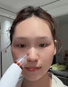 颯望德國吸黑頭儀器可視去黑頭神器去黑頭粉刺油脂面部收縮毛孔清潔家用美容儀超大吸力毛孔強效清潔器 珍珠白【強力清潔】80kpa/真空吸附黑頭粉刺 曬單實(shí)拍圖