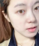 云南白藥（YUNNANBAIYAO）UBUK醫用透明質(zhì)酸鈉修復貼spt面膜痘痘痘印cal面膜ubuk面膜 一盒裝 曬單實(shí)拍圖