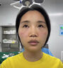 歐誘去眼袋消除重度眼袋專用眼霜去大眼袋嚴重中老年男士祛除神器貼膜 單盒裝 去眼袋最好的眼霜 眼部抗皺精華油專攻男女士 曬單實拍圖
