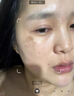 邦孚手美國進(jìn)口硅酮去祛疤痕修復(fù)凝膠醫(yī)用醫(yī)院專用去疤膏兒童手術(shù)縫針 曬單實拍圖