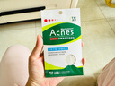 曼秀雷敦（Mentholatum）樂膚潔隱形痘痘貼遮瑕抗痘祛痘日夜雙效52片吸膿隱形女生約會神器 曬單實(shí)拍圖