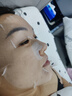 羽素大燈泡祛痘面膜補水保濕精華舒緩修護痘肌男女凈痘全臉痘無酸面膜 曬單實拍圖