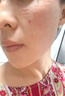 韓國海飛六代不漏液負壓水光機八代家用自打水光儀儀器美容院專(zhuān)用 海菲六代（優(yōu)質(zhì)款）+3套耗材 曬單實(shí)拍圖