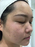 壬二酸煥顏精華凝膠凝露改善暗沉補(bǔ)水保濕滋潤霜官方旗艦店正品 1盒醫(yī)師推薦壬二酸嫩白精華 曬單實(shí)拍圖