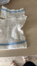 【醫用】picc網(wǎng)狀護理套手臂化療置管保護套彈力繃帶透氣手臂袖套 網(wǎng)狀護理套-M碼(3-5歲兒童) 曬單實(shí)拍圖
