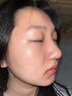 維特絲壬二酸祛痘膏煙酰胺凝膠去痘痘粉刺閉口男女水楊酸收縮毛孔青少年 曬單實拍圖