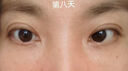 焦博士日本眼膜眼袋貼提拉緊致抗皺淡化細(xì)紋黑眼圈去眼貼膜眼袋眼紋專用 曬單實(shí)拍圖