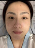 比芭美377安瓶次拋美白精華淡斑精華液提亮去黃淡化色斑黃褐斑黑色素 女 美白淡斑精華 曬單實(shí)拍圖
