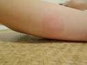南京同仁堂快速瘦去手臂大粗胳膊細蝴蝶減拜拜肉告別麒麟臂美女神燃脂貼 買二贈一(三盒) 曬單實拍圖