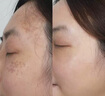 綠典激光溶色膏祛斑后反黑修復(fù)控色霜美容院專用防黑色素回流去黑色素 單瓶控色霜 曬單實(shí)拍圖