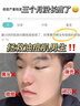 ORGINESE水楊酸控油祛痘洗面奶螨蟲黑頭粉刺閉口青少年氨基酸潔面乳男女士 曬單實(shí)拍圖