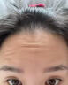 人仁和抬頭紋去除男女士神器額頭去皺紋法令紋去川字紋重度抗衰老專用貼 一盒裝【一抹見效】 曬單實拍圖