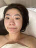 南京同仁堂祛痘膏去痘痘和痘印痘坑修復男女士改善粉刺閉口30g 曬單實(shí)拍圖