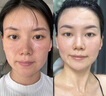 Aromat Herbs澳洲進口面部精華油液玫瑰緊致抗皺衰老淡紋修護刮痧按摩以油養(yǎng)膚 【全球銷量10億瓶+】精油120ml 曬單實拍圖