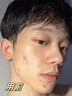 初蔓男士面膜控油祛痘去黑頭收縮毛孔亮白積雪草曬后舒緩保濕補(bǔ)水面膜 【清爽控油】水楊酸亮白面膜*1盒 明星推薦男士面膜熱銷TOP榜 曬單實(shí)拍圖