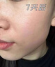 健邦客點痣膏點斑去痣修復(fù)液臉部黑痣痦子美容院專用官方正品 曬單實拍圖