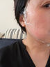 艾薇嵐艾維一型雙美膠原蛋白韓國PCL淡細紋川字紋淚溝改善面部凹 【一支/1ml】防偽-拆封不退(單獨使用或復配水光 曬單實拍圖