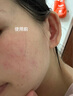 韓方五谷377美白補(bǔ)水保濕水乳液2件套裝爽膚水祛斑霜護(hù)膚化妝品 曬單實(shí)拍圖