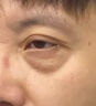 同仁堂眼霜黑眼圈重度去除祛大眼袋女男士淡化細(xì)紋提拉緊致國貨眼霜一名 第2瓶半價(jià)【去除黑眼圈不反復(fù)】 曬單實(shí)拍圖