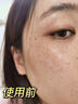 透真377美白精華液次拋淡化黑色素祛斑去黃提亮改善暗沉膚色煙酰胺女 曬單實拍圖