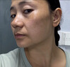 同仁堂祛斑霜美白去黃褐斑老年斑雀斑暗沉淡化黑色素男女士保濕嫩膚面霜 曬單實拍圖