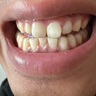 飛利浦（PHILIPS）【肖戰(zhàn)推薦】電動(dòng)牙刷鉆石9系 七夕情人節(jié)禮物送男生/女友 去除99.9%牙漬 HX9911/62藍(lán)色 曬單實(shí)拍圖