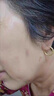 祖郎中去除脖子小肉粒頸部贅皮贅草溫和不留疤祛絲狀尤腋下小猴子去質(zhì)膏 一盒裝（預防護理） 曬單實拍圖