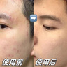 OHBT男士保濕面霜水楊酸維生素b5控油祛痘補(bǔ)水煥白提亮抗皺緊致護(hù)膚品 曬單實(shí)拍圖