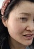 DR.BROKINS點(diǎn)痣膏水疤痕修復臉部去痣官方正品不留疤點(diǎn)斑疣雀斑去黑痣點(diǎn)疣水 三盒裝【2~6顆黑痣、疣、斑】 曬單實(shí)拍圖