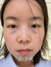 焦博士日本眼霜去眼袋消除重度眼袋專用黑眼圈重度去除女男士中老年神器 曬單實(shí)拍圖