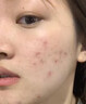 壯大夫海芝牌逗特可麗丸美容祛痤瘡痘痘粉刺官方正品保障旗艦店 6袋*5盒【頑固裝】日常美白祛痤瘡，92.3%用戶 曬單實拍圖