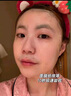 水光針激光祛痘印痘坑超皮秒醫美術(shù)后修復面膜貼醫用敷料補水保濕 1盒5片【醫用無(wú)菌】 曬單實(shí)拍圖