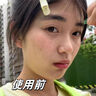 377美白面霜祛斑霜去斑淡斑煙酰胺精華提亮膚色正品套裝 50g/1罐 【美白祛斑】 曬單實(shí)拍圖