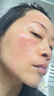 北宮素清霜敏感肌臉部泛紅改善紅血絲紅斑去臉上干燥脫屑痤瘡面霜 【敏感肌面膜款 】輕度裝 曬單實(shí)拍圖
